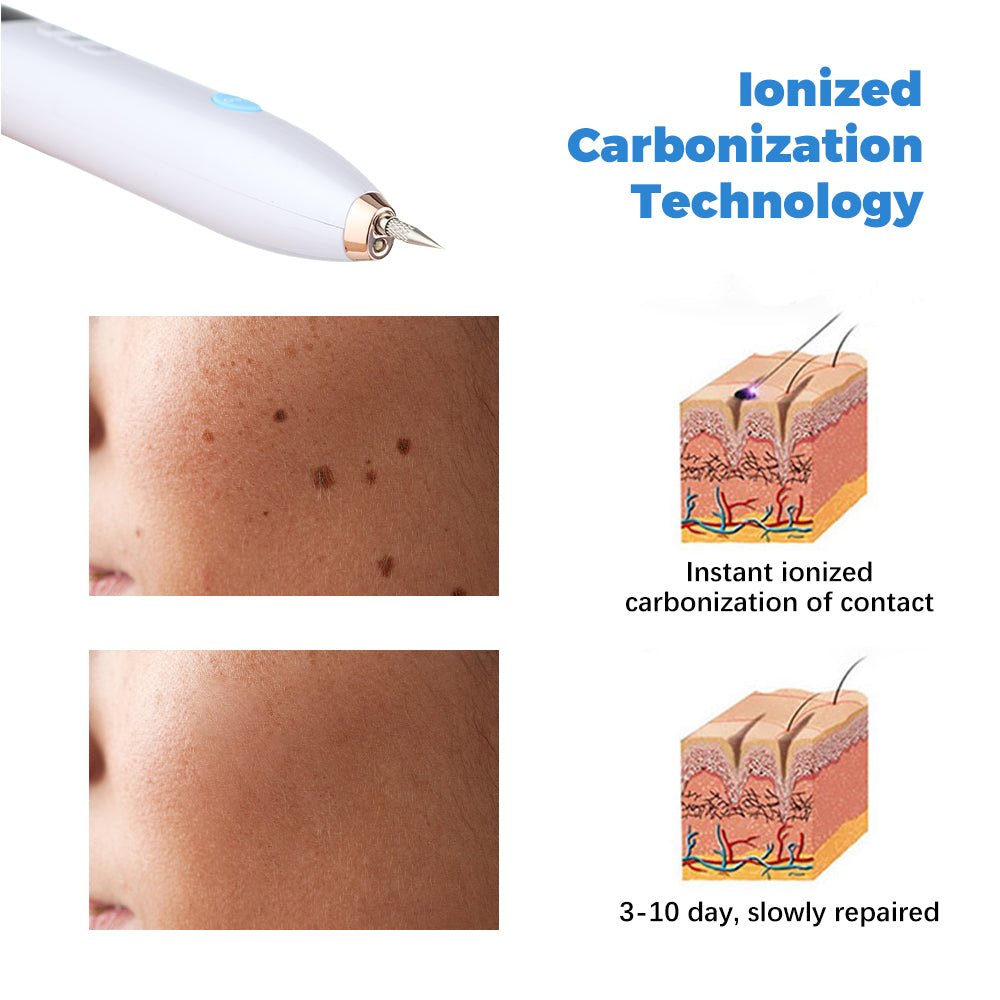 Mole Removal Plasma Pen